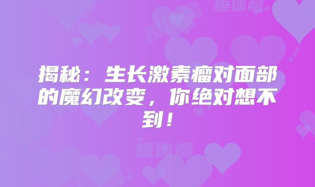揭秘：生长激素瘤对面部的魔幻改变，你绝对想不到！