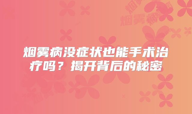 烟雾病没症状也能手术治疗吗？揭开背后的秘密