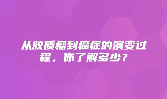 从胶质瘤到癌症的演变过程，你了解多少？