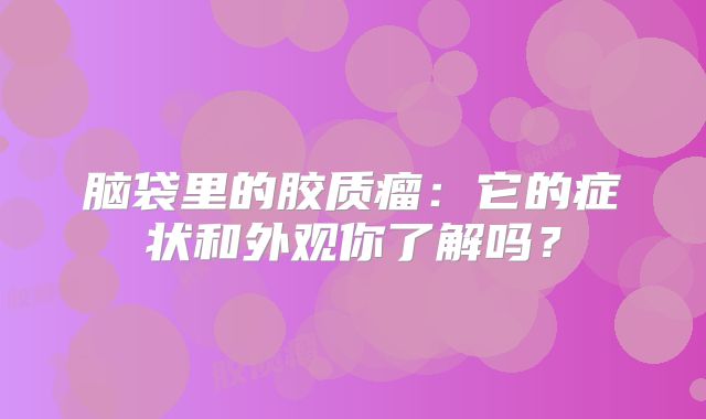 脑袋里的胶质瘤：它的症状和外观你了解吗？
