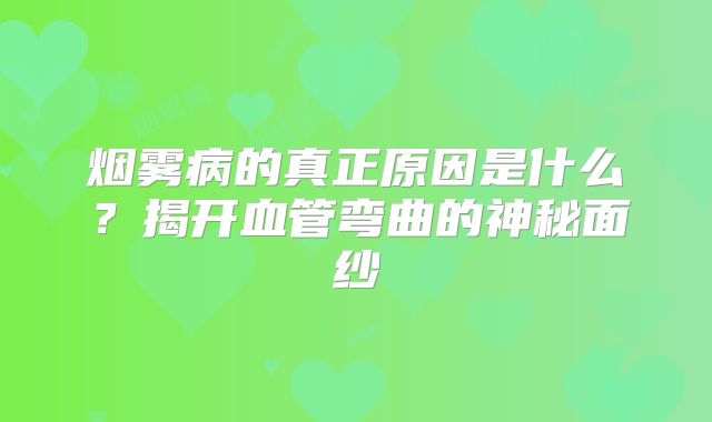 烟雾病的真正原因是什么？揭开血管弯曲的神秘面纱