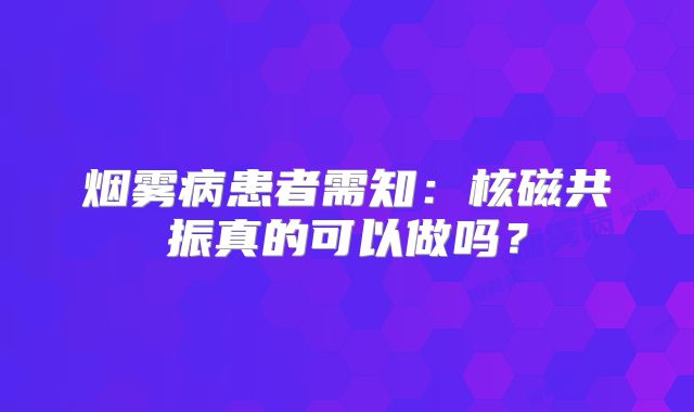 烟雾病患者需知：核磁共振真的可以做吗？