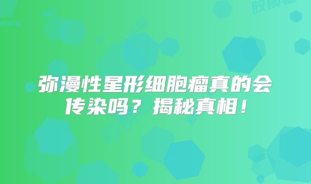 弥漫性星形细胞瘤真的会传染吗？揭秘真相！