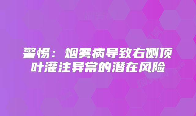 警惕：烟雾病导致右侧顶叶灌注异常的潜在风险