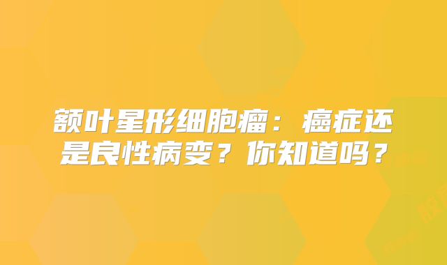 额叶星形细胞瘤：癌症还是良性病变？你知道吗？
