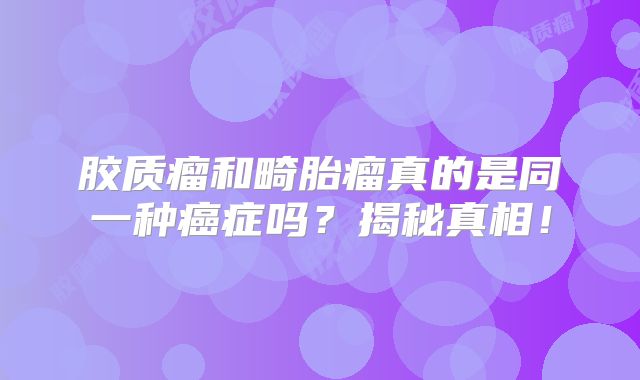 胶质瘤和畸胎瘤真的是同一种癌症吗？揭秘真相！