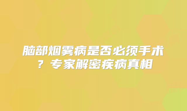 脑部烟雾病是否必须手术？专家解密疾病真相