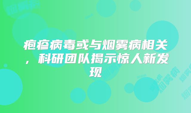 疱疹病毒或与烟雾病相关，科研团队揭示惊人新发现