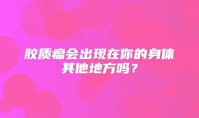 胶质瘤会出现在你的身体其他地方吗？