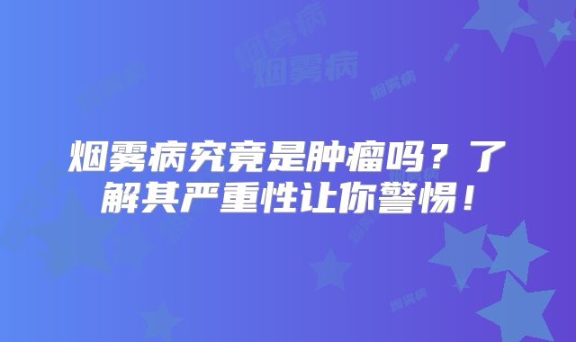 烟雾病究竟是肿瘤吗？了解其严重性让你警惕！