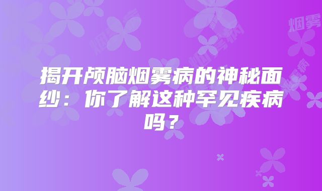 揭开颅脑烟雾病的神秘面纱：你了解这种罕见疾病吗？