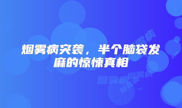 烟雾病突袭，半个脑袋发麻的惊悚真相