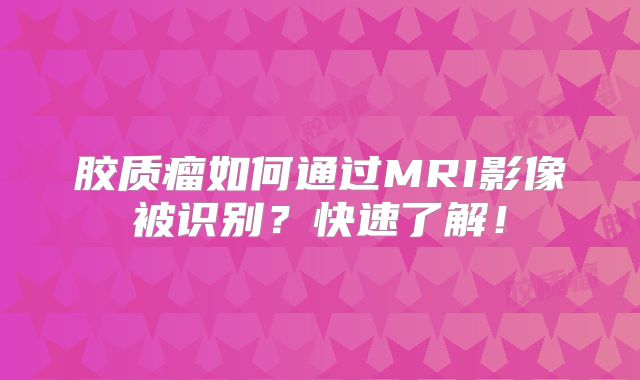 胶质瘤如何通过MRI影像被识别？快速了解！