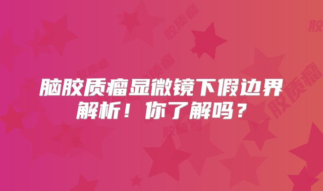 脑胶质瘤显微镜下假边界解析！你了解吗？