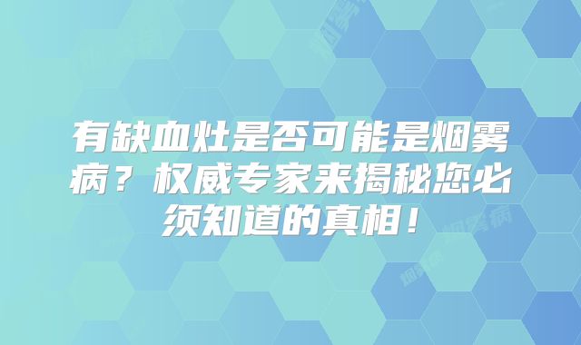 有缺血灶是否可能是烟雾病？权威专家来揭秘您必须知道的真相！