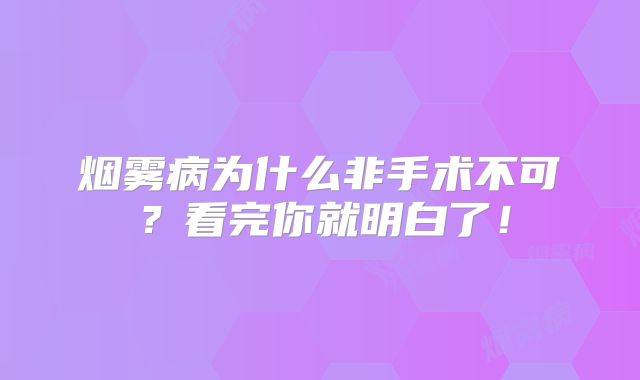 烟雾病为什么非手术不可？看完你就明白了！
