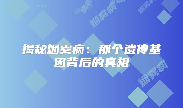 揭秘烟雾病：那个遗传基因背后的真相