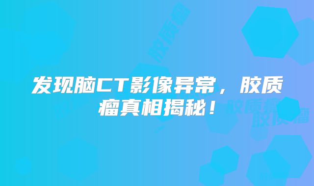 发现脑CT影像异常，胶质瘤真相揭秘！