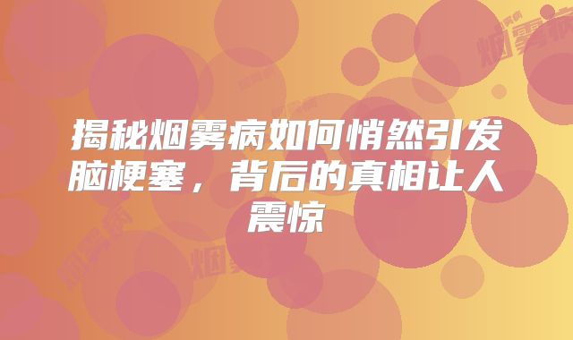 揭秘烟雾病如何悄然引发脑梗塞，背后的真相让人震惊
