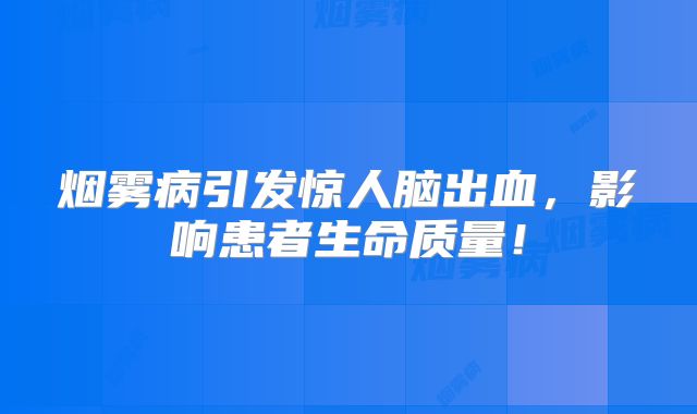 烟雾病引发惊人脑出血，影响患者生命质量！
