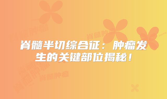 脊髓半切综合征：肿瘤发生的关键部位揭秘！