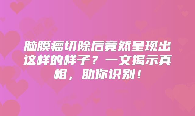 脑膜瘤切除后竟然呈现出这样的样子？一文揭示真相，助你识别！