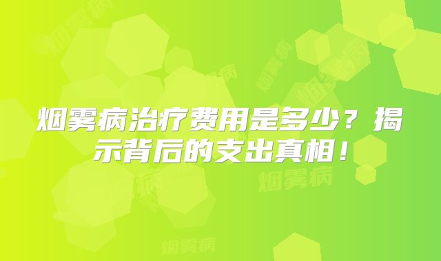 烟雾病治疗费用是多少？揭示背后的支出真相！