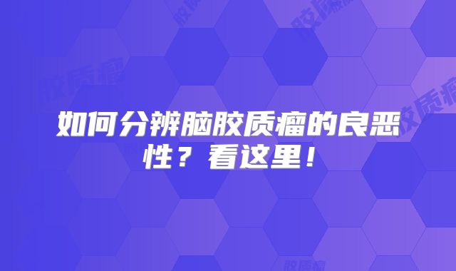 如何分辨脑胶质瘤的良恶性？看这里！