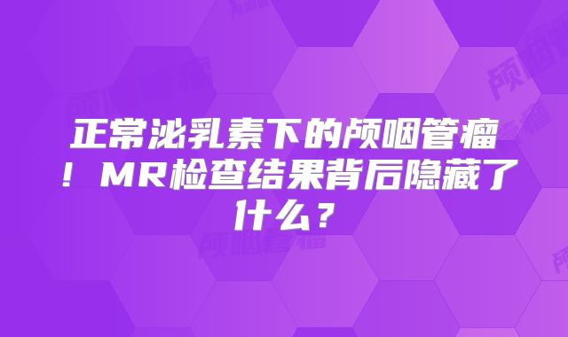 正常泌乳素下的颅咽管瘤！MR检查结果背后隐藏了什么？