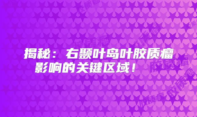 揭秘：右颞叶岛叶胶质瘤影响的关键区域！  