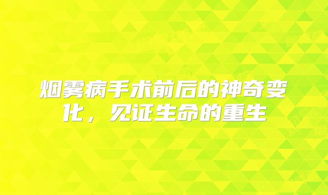 烟雾病手术前后的神奇变化，见证生命的重生