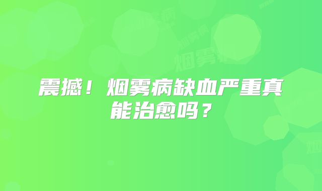 震撼！烟雾病缺血严重真能治愈吗？