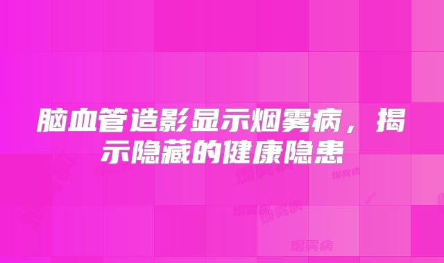 脑血管造影显示烟雾病，揭示隐藏的健康隐患