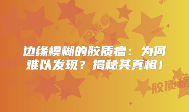 边缘模糊的胶质瘤：为何难以发现？揭秘其真相！