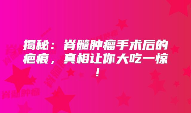 揭秘：脊髓肿瘤手术后的疤痕，真相让你大吃一惊！