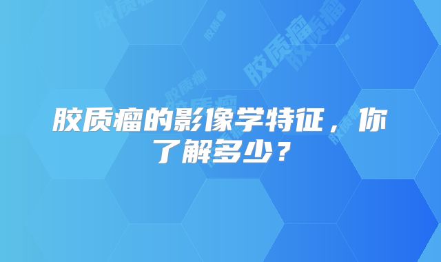 胶质瘤的影像学特征，你了解多少？