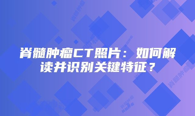 脊髓肿瘤CT照片：如何解读并识别关键特征？