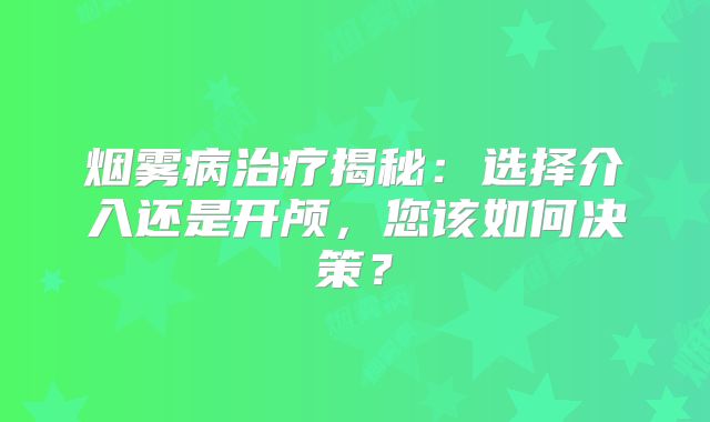 烟雾病治疗揭秘：选择介入还是开颅，您该如何决策？