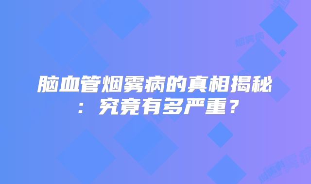 脑血管烟雾病的真相揭秘：究竟有多严重？