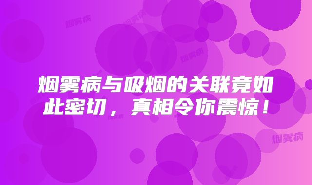 烟雾病与吸烟的关联竟如此密切，真相令你震惊！