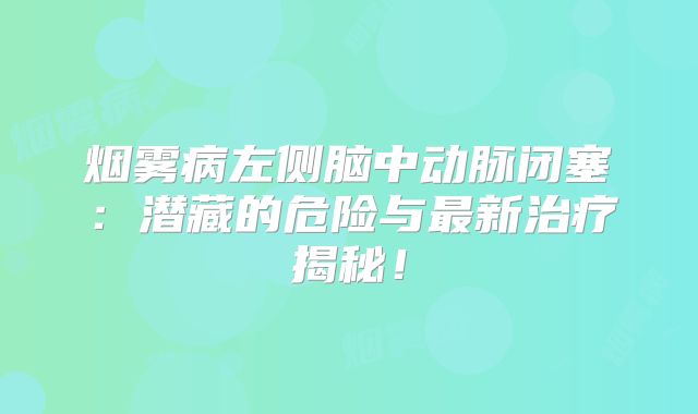 烟雾病左侧脑中动脉闭塞：潜藏的危险与最新治疗揭秘！