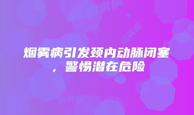 烟雾病引发颈内动脉闭塞，警惕潜在危险