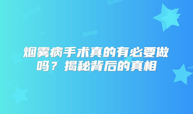 烟雾病手术真的有必要做吗？揭秘背后的真相