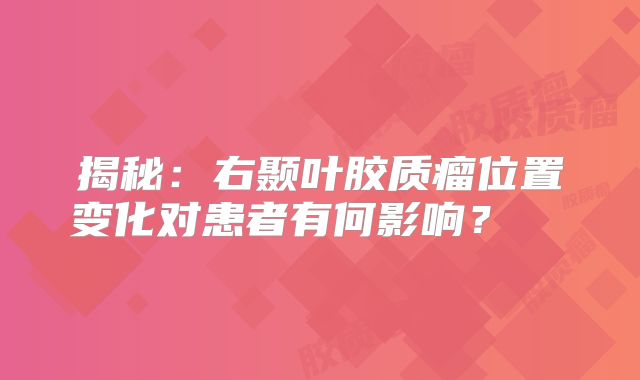 揭秘：右颞叶胶质瘤位置变化对患者有何影响？  