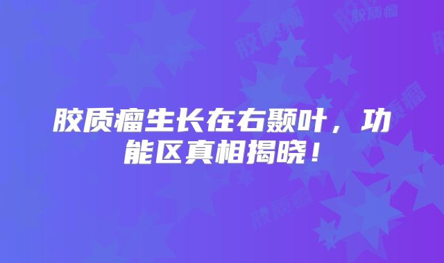 胶质瘤生长在右颞叶，功能区真相揭晓！