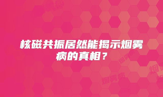 核磁共振居然能揭示烟雾病的真相？
