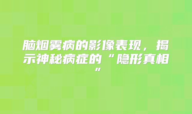脑烟雾病的影像表现，揭示神秘病症的“隐形真相”