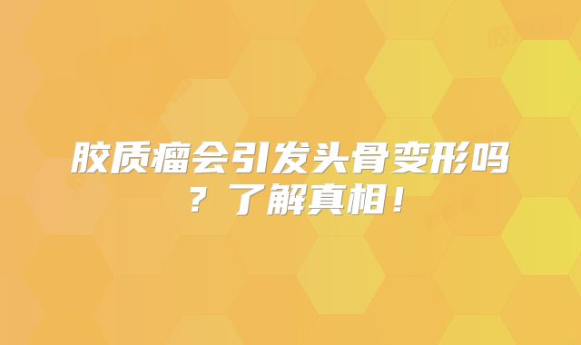 胶质瘤会引发头骨变形吗？了解真相！