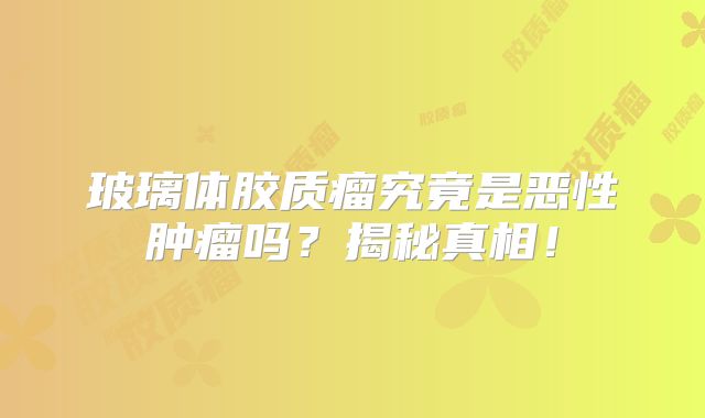玻璃体胶质瘤究竟是恶性肿瘤吗？揭秘真相！