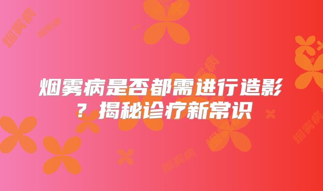烟雾病是否都需进行造影？揭秘诊疗新常识